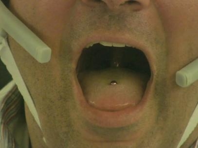 O piercing do tamanho de um feijo produz um campo magntico que muda quando a lngua se movimenta