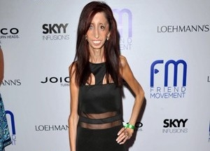 Lizzie Velasquez prepara filme 'anti-bullying'